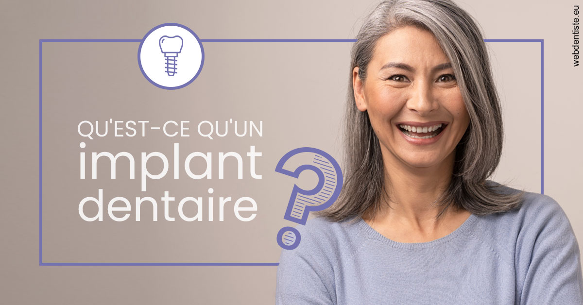 https://www.dr-thierry-jasion.fr/Implant dentaire 1