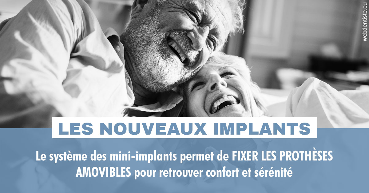 https://www.dr-thierry-jasion.fr/Les nouveaux implants 2