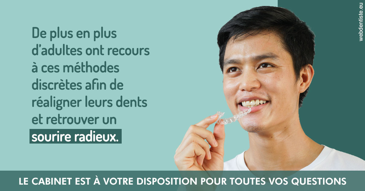 https://www.dr-thierry-jasion.fr/Gouttières sourire radieux 2