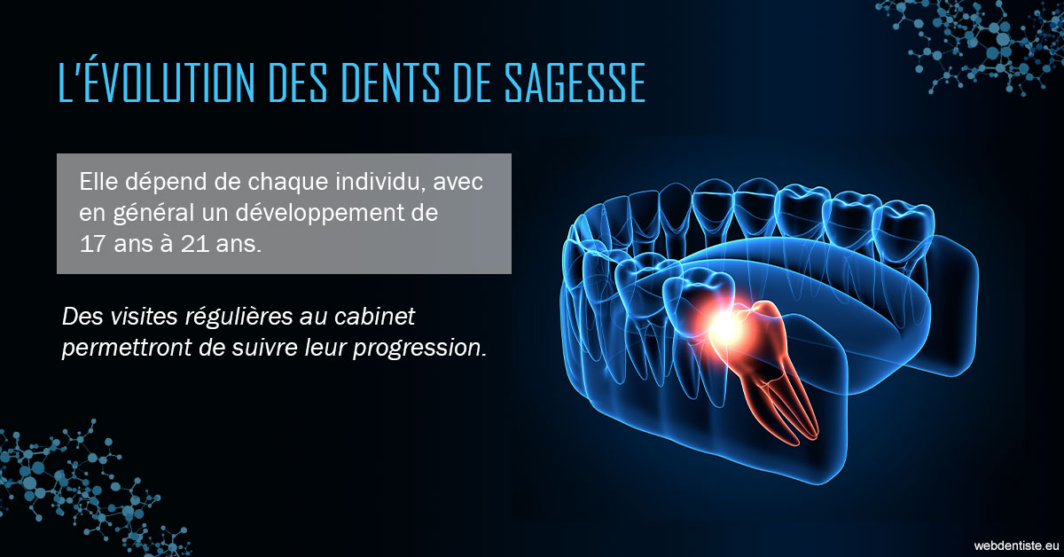 https://www.dr-thierry-jasion.fr/2023 T4 - Dents de sagesse 01