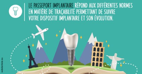 https://www.dr-thierry-jasion.fr/Le passeport implantaire