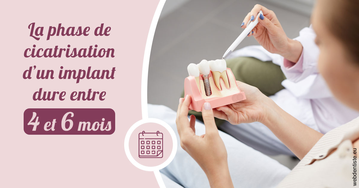 https://www.dr-thierry-jasion.fr/Cicatrisation implant 2