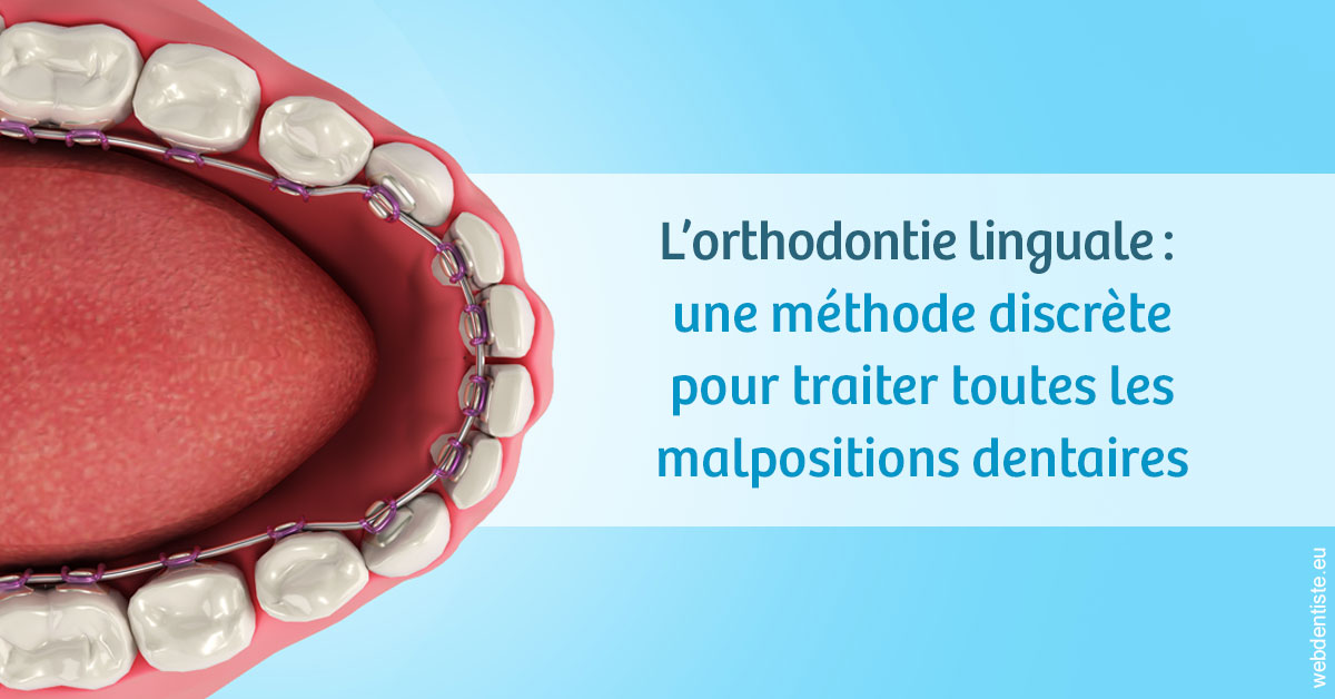 https://www.dr-thierry-jasion.fr/L'orthodontie linguale 1