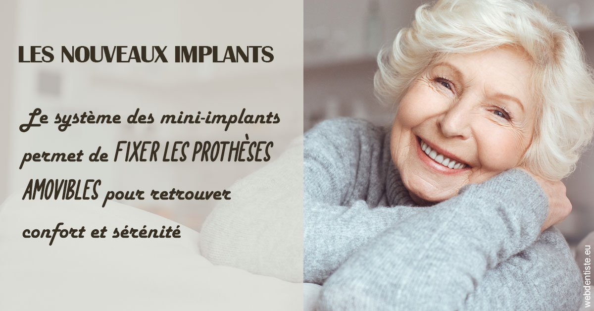 https://www.dr-thierry-jasion.fr/Les nouveaux implants 1