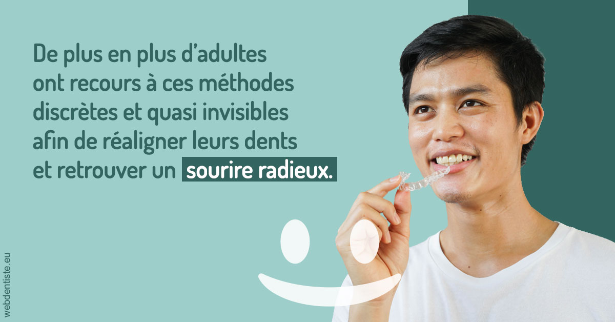 https://www.dr-thierry-jasion.fr/Gouttières sourire radieux 2