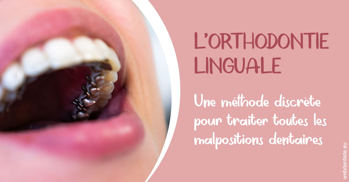 https://www.dr-thierry-jasion.fr/L'orthodontie linguale 2