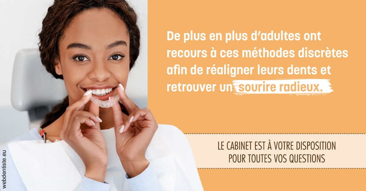 https://www.dr-thierry-jasion.fr/Gouttières sourire radieux