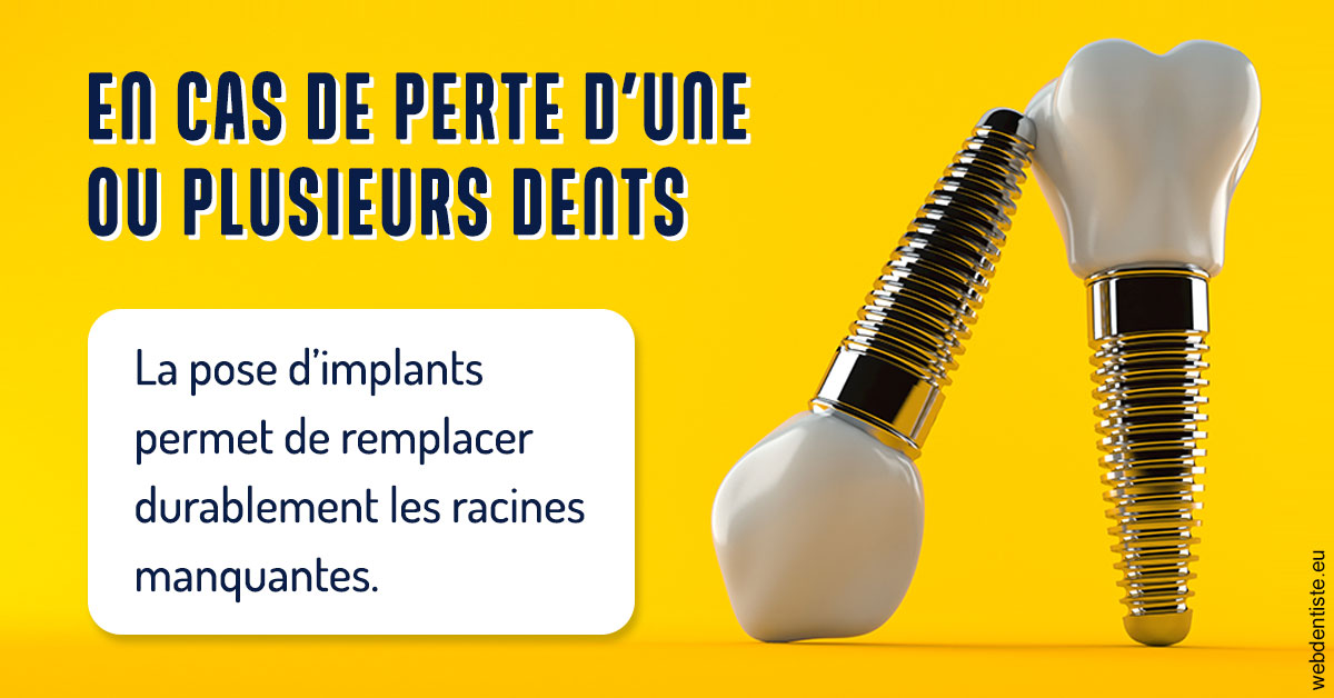 https://www.dr-thierry-jasion.fr/2024 T1 - Implants 02
