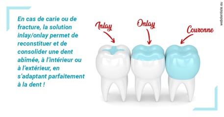 https://www.dr-thierry-jasion.fr/L'INLAY ou l'ONLAY