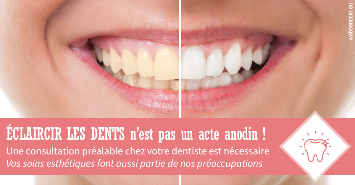https://www.dr-thierry-jasion.fr/Eclaircir les dents 1