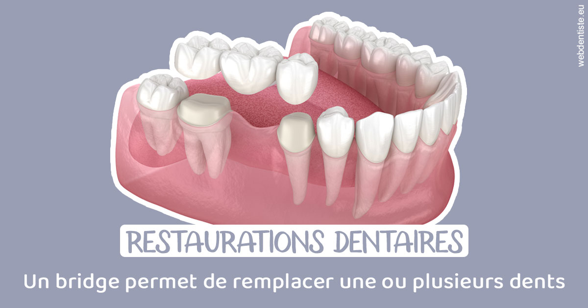 https://www.dr-thierry-jasion.fr/Bridge remplacer dents 1