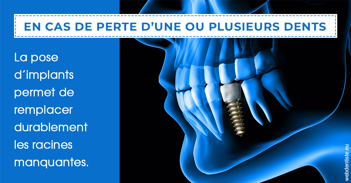 https://www.dr-thierry-jasion.fr/2024 T1 - Implants 01