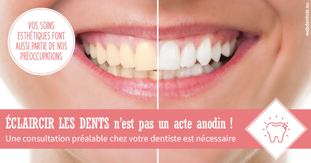 https://www.dr-thierry-jasion.fr/Eclaircir les dents 1