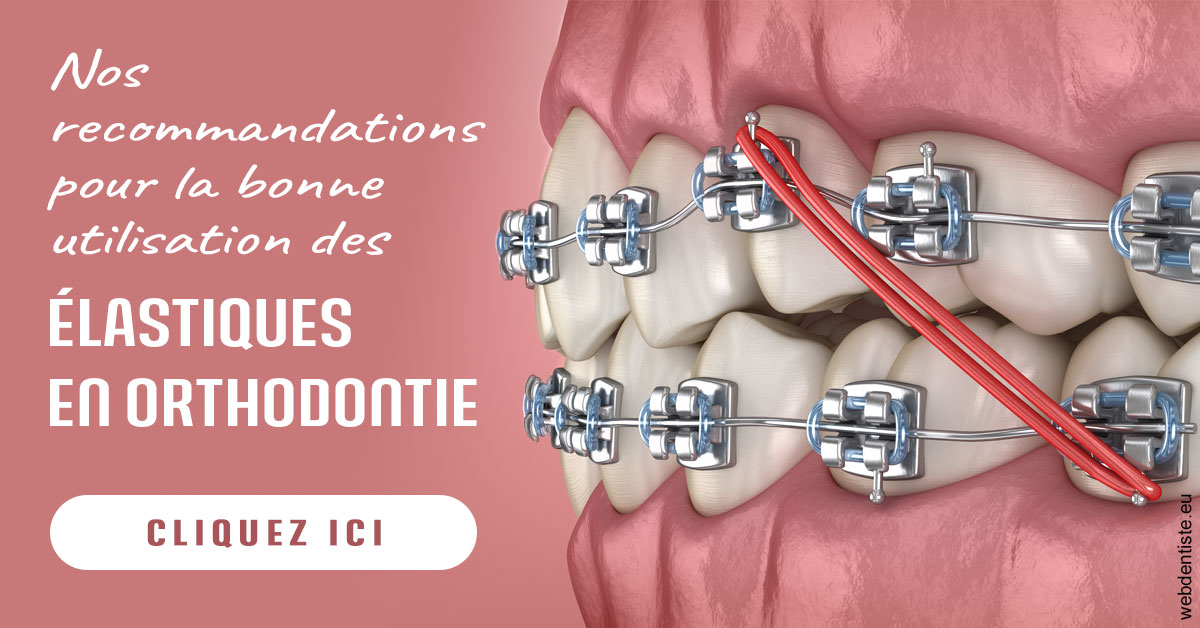 https://www.dr-thierry-jasion.fr/Elastiques orthodontie 2